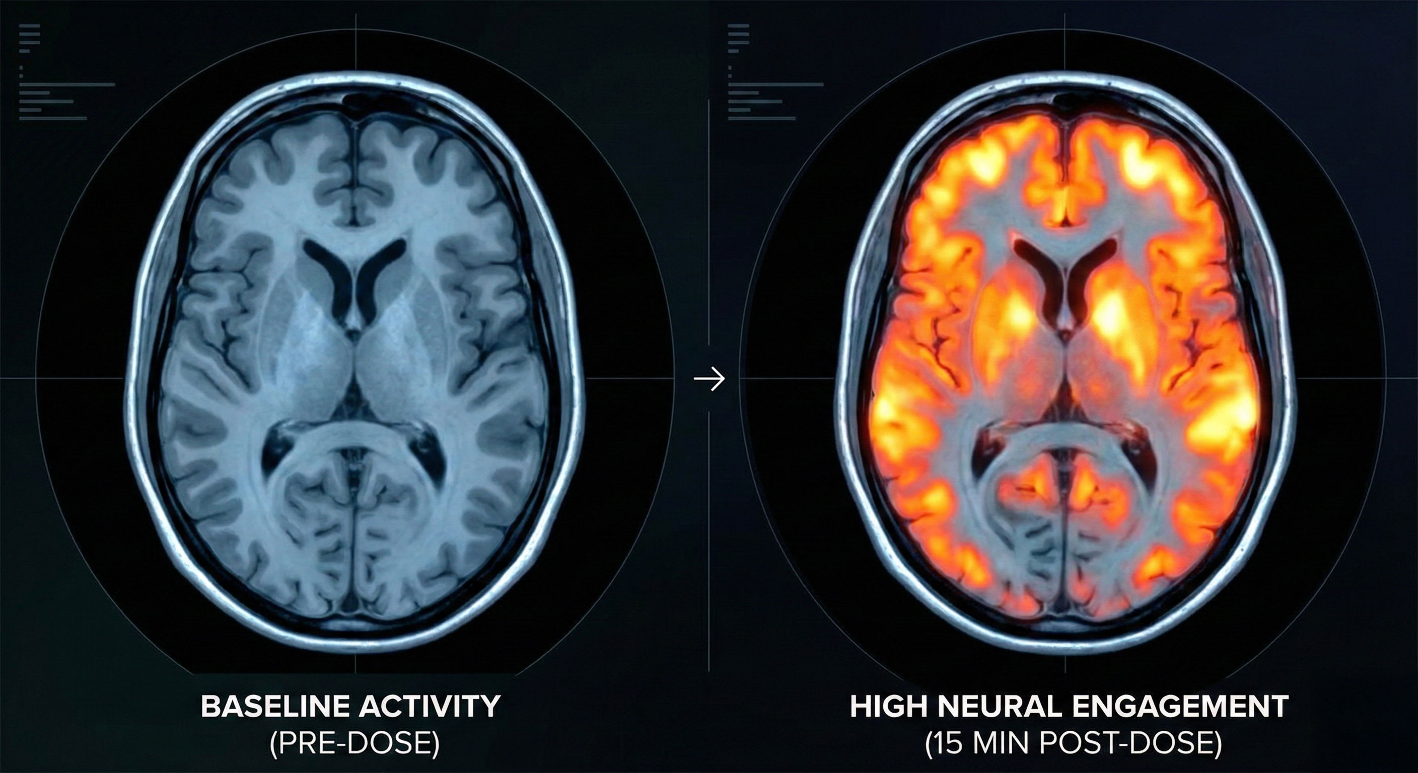 fMRI brain activity comparison — caffeine vs Flow Drops at 15 minutes
